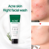 AHA-BHA-PHA 30 DAYS MIRACLE ACNE CLEAR FOAM