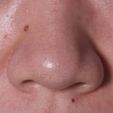 Blackhead Out Sheet <b>| Parche elimina puntos negros</b> TIAM